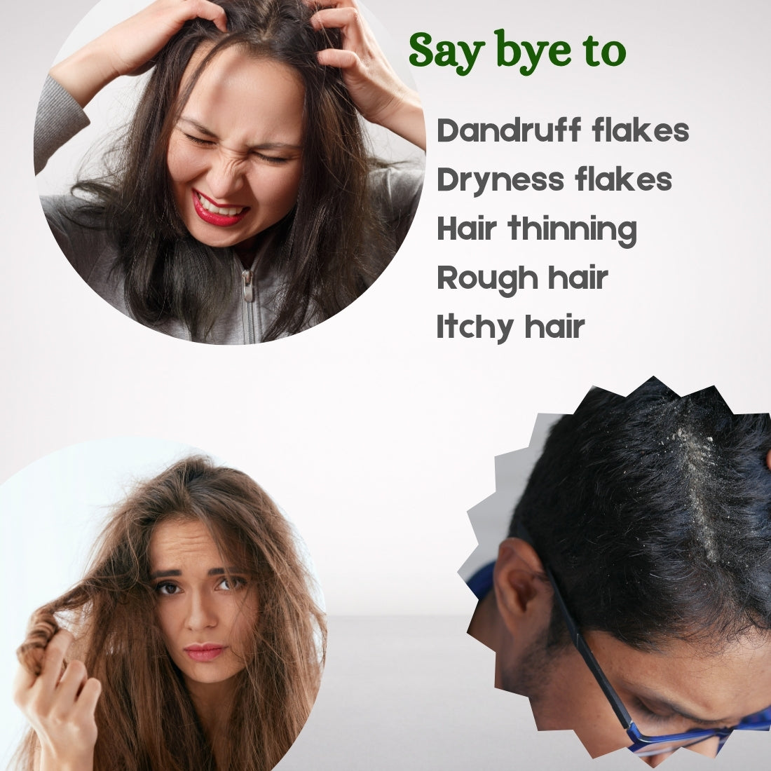 Dandruff Control Oil